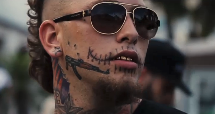 Stitches